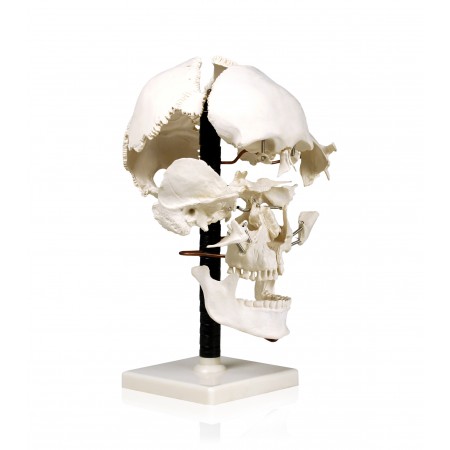 Walter Beauchene Skull