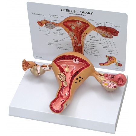 Uterus and Ovaries Model