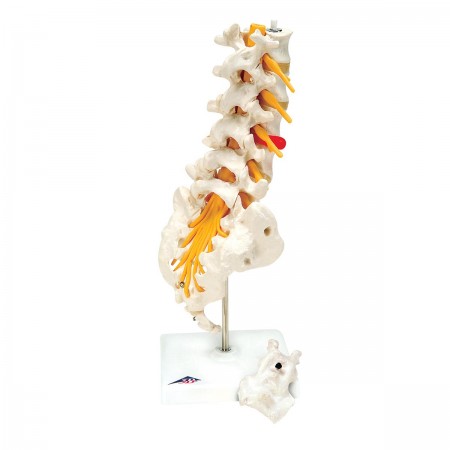 3B Lumbar Spinal Column w/Prolapsed Disc