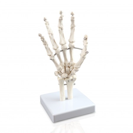 Walter Hand Skeleton