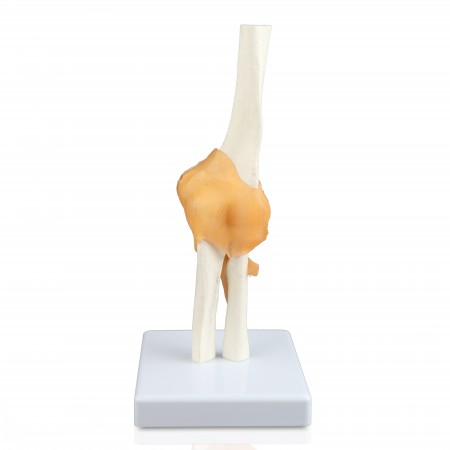Walter Elbow Joint