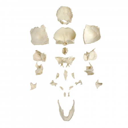 Walter Disarticulated Skull
