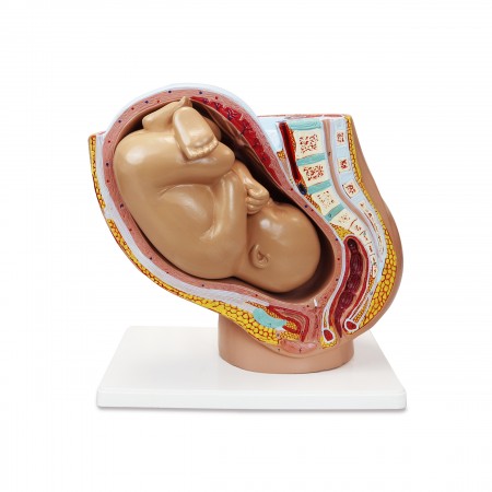 Walter Pregnancy Pelvis with Mature Fetus