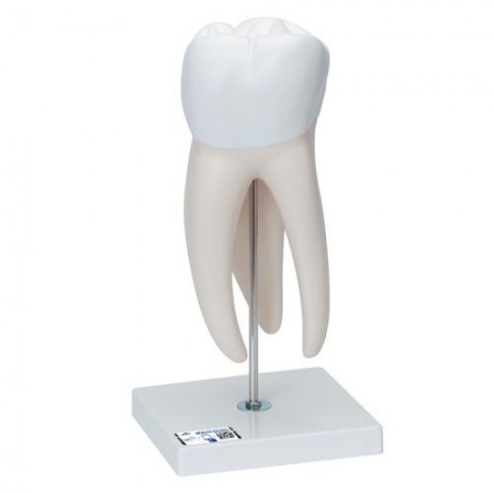 3B Giant Molar with Dental Caries, 15X Life-Size - 6 Parts