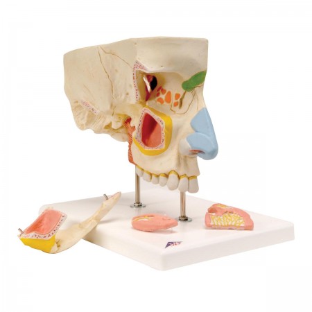 3B Nose with Paranasal Sinuses, 1.5X Life-Size - 5 Parts