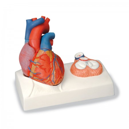 3B Heart Model w/Representation of Systole, Life-Size - 5 Parts