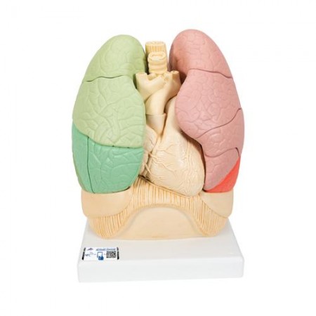 3B Segmented Lung Model