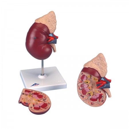 3B Kidney w/Adrenal Gland - 2 Parts