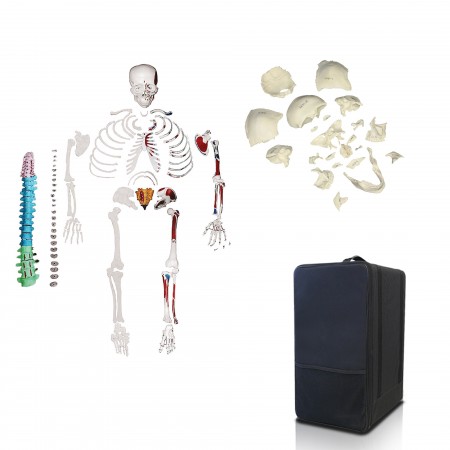 Disarticulated Skeleton & Disarticulated Skull Set With Carrying Case