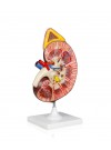 Walter Kidney Model