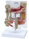 Colon Model