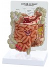 Lower GI Tract