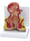 Rectum Model