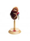 Denoyer Right Kidney and Adrenal Gland