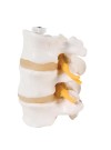 3B 3 Lumbar Vertebrae, Flexibly Mounted