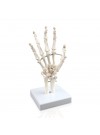 Walter Hand Skeleton