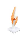 Walter Knee Joint