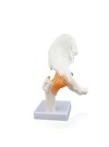 Walter Hip Joint