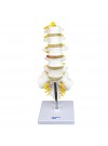 Walter Lumbar Spinal Column 
