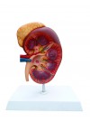 Walter Kidney w/Adrenal Gland