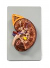Walter Kidney Model
