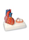 3B Heart Model w/Representation of Systole, Life-Size - 5 Parts
