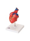 3B Classic Heart w/Bypass - 2 Parts