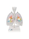 3B CT Bronchial Tree Model with Larynx & Transparent Lungs