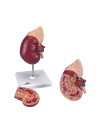 3B Kidney w/Adrenal Gland - 2 Parts