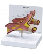 Artery Model 