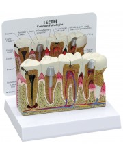 Teeth with Common Pathologies 