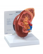 Kidney Model 