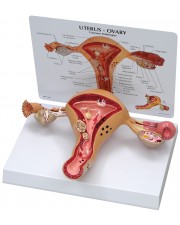 Uterus and Ovaries Model 