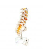 3B Lumbar Spinal Column w/Prolapsed Disc 