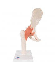 3B Deluxe Functional Hip Joint, Physiological Movable 