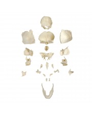 Walter Disarticulated Skull 
