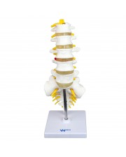 Walter Lumbar Spinal Column  
