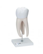 3B Giant Molar with Dental Caries, 15X Life-Size - 6 Parts 