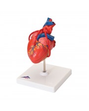 3B Classic Heart w/Bypass - 2 Parts 