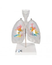 3B CT Bronchial Tree Model with Larynx & Transparent Lungs 