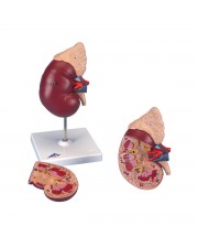 3B Kidney w/Adrenal Gland - 2 Parts 