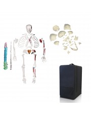 Disarticulated Skeleton & Disarticulated Skull Set With Carrying Case 